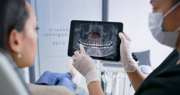 Licensed Tooth Extraction service in Bennettsville, SC - Smile Center Dentistry